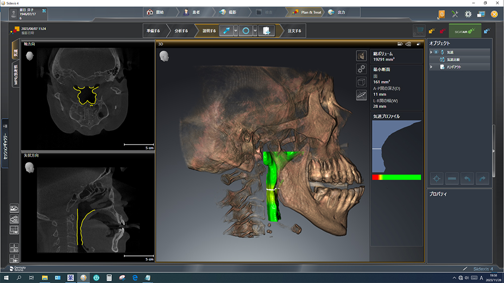 下顎を前に出した状態